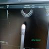 Buy cheap Medical Device Repair Cases OF GE RIC5-9-D ULTRASOUND PROBE FOR REPAIR from wholesalers