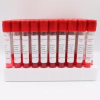 Buy cheap 5ml Special Thread Sample Collection Tube Ethylene Oxide product