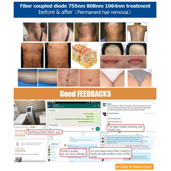 German Pump Diode Laser 808 Hair Removal 808nm Beauty Equipment Machine