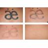 Buy cheap Best High Energy 1500mj 1064nm 532nm Painless Permanent Skin Age Spot Freckle Removal Machine Yag Laser Remove Tattoo from wholesalers