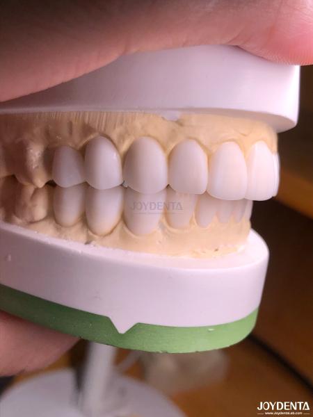 Buy cheap Customized Digital Diagnostic Wax Ups for Natural Tooth Anatomy Replication from wholesalers