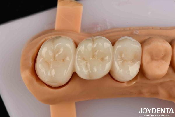 Buy cheap High Flexural Strength Full Contour Zirconia For Crowns Bridges Dental Restoration from wholesalers