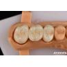 Buy cheap High Flexural Strength Full Contour Zirconia For Crowns Bridges Dental Restoration from wholesalers