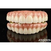 Buy cheap High Durability Ti-Bar Zirconia Hybrid Bridge The Ultimate Choice for Achieving product