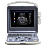 Buy cheap 4D Portable color doppler machine product