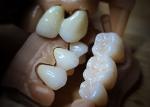 Dental Restoration Teeth Zirconia dental Crowns crafted by china dental lab