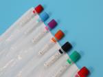 Vacuette Evacuated Blood Sample Centrifuge Tube For Medical Laboratory