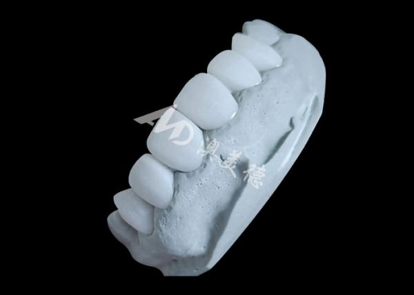 Zirconia Dental Crown Delivering Unbeatable Strength And Natural Smoothness,And