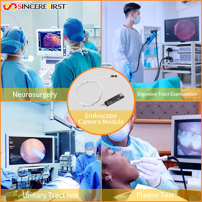 Micro 6mm OV9734 Sensor USB UVC Side View Endoscope Camera Module