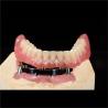 Buy cheap CAM Milled Titanium Bar Dental Implant Hybrid Prosthesis Dentures from wholesalers