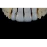 Buy cheap Handcrafted Porcelain Feldspathic Dental Veneer Natural Looking from wholesalers