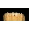 Buy cheap Dental Lab Fixed Prosthetics Layered Zirconia Dental Crown For Front Teeth from wholesalers