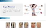 Factory price vertical 808nm diode laser soprano medical CE professional hair
