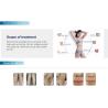 Buy cheap Factory price vertical 808nm diode laser soprano medical CE professional hair removal machine from wholesalers