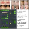 Buy cheap SHR Super Hair Removal IPL SHR / SHR IPL / SHR Hair Removal Machine opt hair removal from wholesalers
