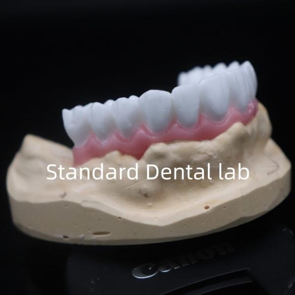 Buy cheap High Esthetics White Dental Crown Diagnostic Wax Up Customized China Dental Lab from wholesalers