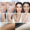 Buy cheap Touch Screen Nd Yag Soprano Laser Machine 808nm For Hair and Tattoo Removal from wholesalers