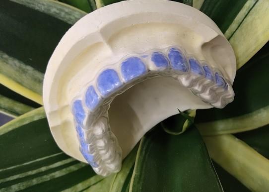 Buy cheap ISO13485 Teeth Whitening Bleach Guard For Smoke Stains from wholesalers