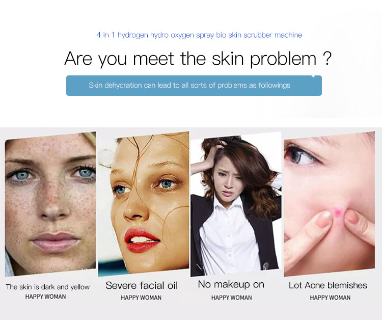 Astiland 4 In-1 Portable Facial Skin Care Machine Water Hydra Dermabrasion Oxygen Jet Peel Facial Care Machine