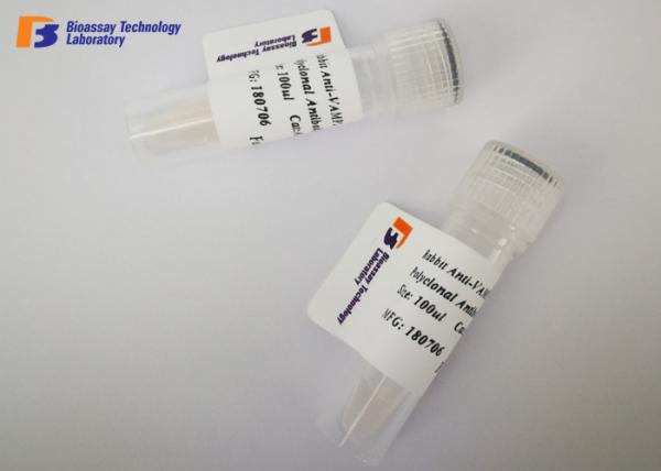 Buy cheap Customized NSE Mouse Monoclonal Antibodies at -20 °C Storage Temperature from wholesalers