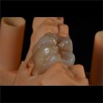 Personalized Strong Ceramic Zirconia Dental Crown Full Mouth Full Contour