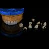 Buy cheap Dentists Cad Cam PFM Crown Ceramic Material Metal Foundation from wholesalers