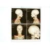 Buy cheap High Density Medical X Ray Film Blue For Konida Laser Printer from wholesalers