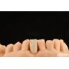 Buy cheap Ideal Matching Clinical Bonding Maryland Dental For Oral Clinical Repair Work from wholesalers
