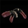 Buy cheap Precision Zirconia PFM Crowns Partial Dentures Natural Looking from wholesalers