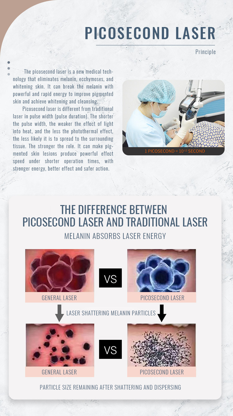 Q Switch Picosecond Laser Tattoo Removal Machine 1320nm For Clinic