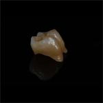 Personalized Strong Ceramic Zirconia Dental Crown Full Mouth Full Contour