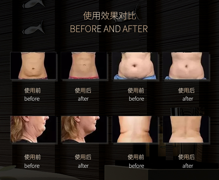 Portable Cellulite Removal Ems Beauty Device Ultrasound 40K Cavitation Weight Loss Lymphatic Detoxification Body Slimming Mach