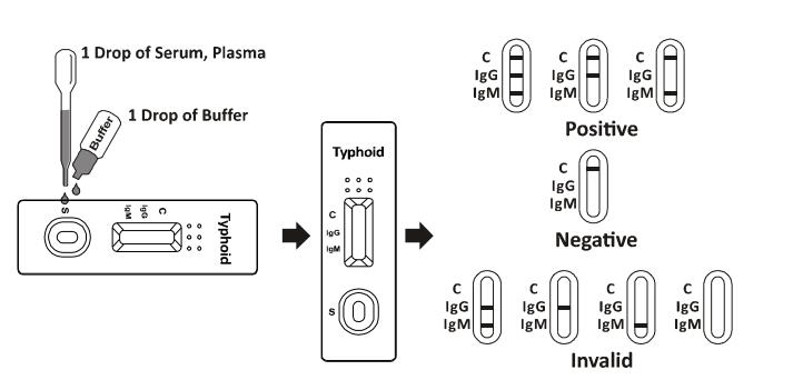 Typhoid IgG/IgM Rapid Test,Flow Immunochromatographic Assays , Infectious Disease Test Kit