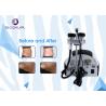 Buy cheap 1200W Power Non Surgical Liposuction Machine With Vacuum Cavitation System from wholesalers