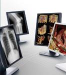 Clear picture Medical Grade Displays , 5MP Gray Scale Medical Display