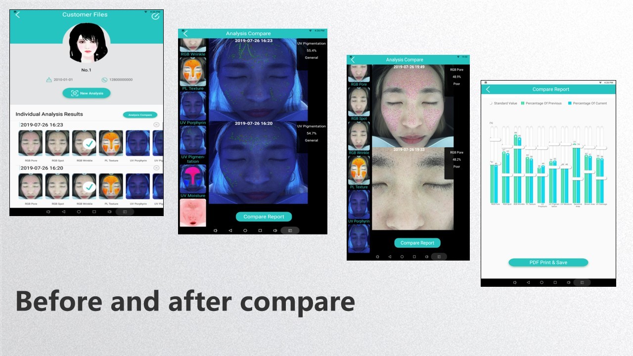 Face Magic Mirror Skin Analyzer 2.0 Port USB Wifi Connection With UV Lighting