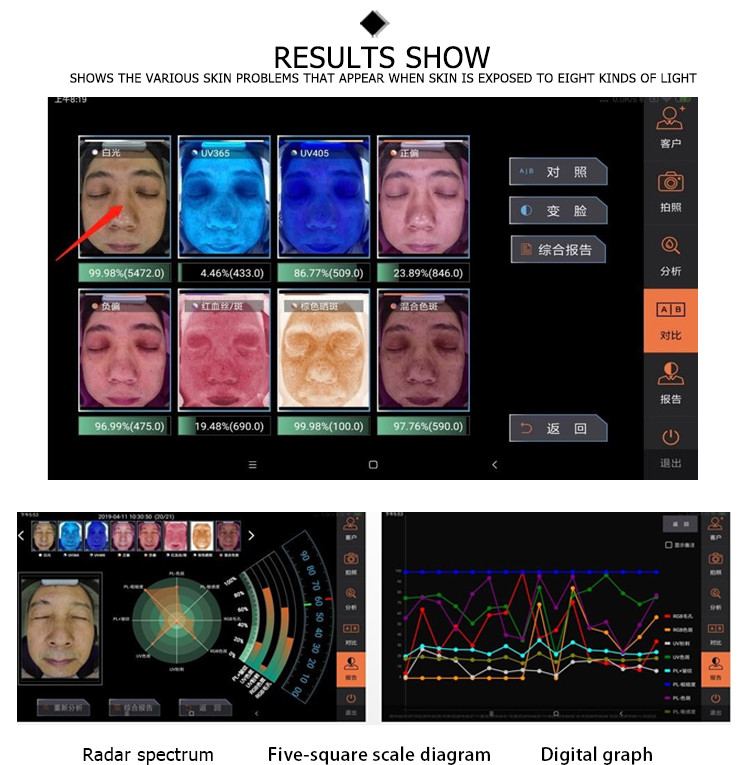 problem skin test sk-03 Uv Detection care facial skin diagnosis machine hd smart wifi mlg wireless skin hair analyzer