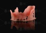 Orange Pink Acrylic Partial Denture Natural Looking 3d Printing Digital Dentures
