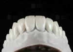 Buy cheap Natural Pressed EMAX Veneer Strength 16 Shades Emax Teeth Veneers from wholesalers