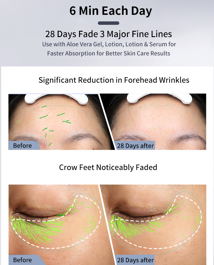 850mAh Battery V Facial RF Beauty Instrument For Personal Care