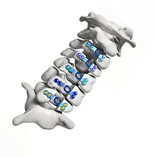 Buy cheap 6mm - 16mm Laminoplasty Plate Cervical Spine Open Door Plate Titanium Alloy from wholesalers