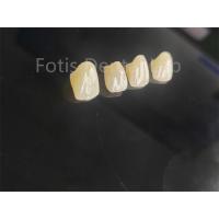Buy cheap Professional Grade Porcelain Fused Zirconia For Perfectly Fitting Dental product