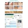 Buy cheap 808 nm diode laser hair removal machine for spa/clinic/salon use permanent,painless hair remove from wholesalers