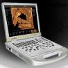 Buy cheap 4D Baby Portable Medical Color Doppler Ultrasound Machine from wholesalers