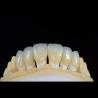Buy cheap Dental Lab Teeth Feldspathic Porcelain Veneers Custom Shaped from wholesalers