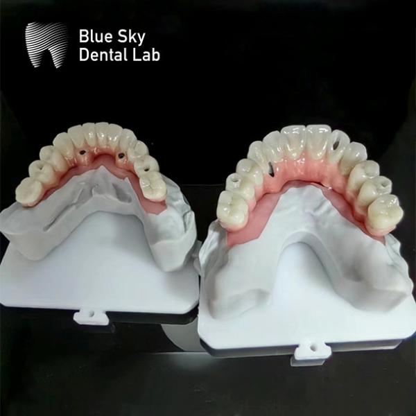 Buy cheap Blue Sky Implant Full Arch Implant Cases Nature Implantation Cases from wholesalers