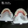 Buy cheap Blue Sky Implant Full Arch Implant Cases Nature Implantation Cases from wholesalers