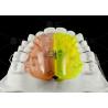 Buy cheap Orthodontic Fan Shaped Expander Provides Posterior Crossbite Free Section Expansion from wholesalers