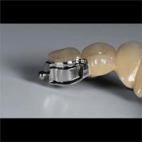 Buy cheap Aesthetic Precision Dental Implant Ball Attachment Partial Dentures product