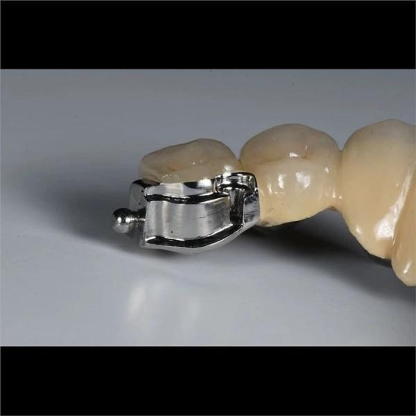 Buy cheap Aesthetic Precision Dental Implant Ball Attachment Partial Dentures from wholesalers